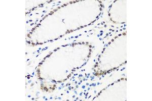Immunohistochemistry of paraffin-embedded human stomach using HTATSF1 antibody (ABIN5973562) at dilution of 1/100 (40x lens). (HTATSF1 anticorps)