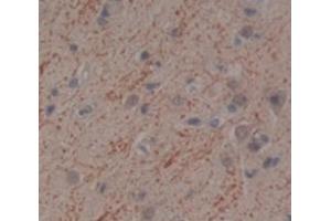 IHC-P analysis of Human Tissue, with DAB staining. (IFNA10 anticorps  (AA 24-189))
