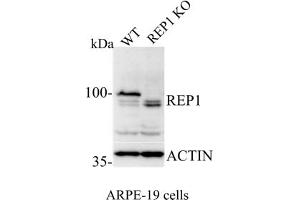 Western Blotting (WB) image for anti-Choroideremia (Rab Escort Protein 1) (CHM) (C-Term) antibody (ABIN6254221) (CHM anticorps  (C-Term))