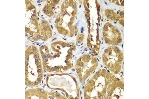 Immunohistochemistry of paraffin-embedded human kidney using RAB1B antibody (ABIN4904923) at dilution of 1:100 (40x lens). (RAB1B anticorps)