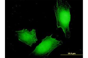 Immunofluorescence of monoclonal antibody to MAGEA4 on HeLa cell.