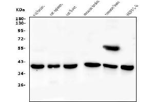 Western blot analysis of PPID using anti-PPID antibody (ABIN6719438). (PPID anticorps  (AA 306-370))