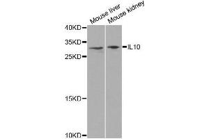 Western blot analysis of extracts of various cell lines, using IL10 antibody. (IL-10 anticorps  (AA 19-178))