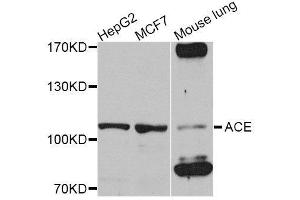 Western blot analysis of extracts of various cell lines, using ACE antibody.