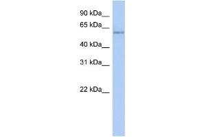WB Suggested Anti-CPNE4 Antibody Titration: 0. (Copine IV anticorps  (N-Term))