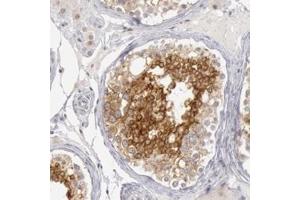 Immunohistochemical staining of human breast with RIMBP3 polyclonal antibody  shows strong cytoplasmic positivity in cells in seminiferus ducts. (RIMBP3 anticorps)