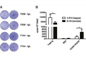 Goat anti-Ferret IgA, IgG, IgM antibody