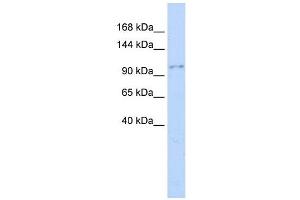 NEDD4 antibody used at 1 ug/ml to detect target protein. (NEDD4 anticorps  (Middle Region))