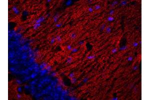 Indirect immunofluorescence labeling of a PFA fixed mouse hippocampus section (dilution 1 : 200; red).
