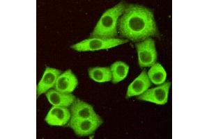 Immunocytochemistry of HeLa cells fixed by Paraformaldehyde and using DR5 mouse mAb diluted 1:100. (TNFRSF10B anticorps)