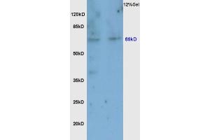 Rat brain lysates probed with Anti Nrf2 Polyclonal Antibody, Unconjugated  at 1:200 overnight at 4˚C.