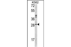 Western blot analysis of ITGB1BP3 Antibody in K562 cell line lysates (35ug/lane) (ITGB1BP3 anticorps  (N-Term))