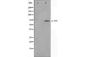 Western blot analysis on Jurkat cell lysate using p73 Antibody. (Tumor Protein p73 anticorps  (Internal Region))