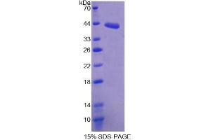 SDS-PAGE analysis of Mouse SDHC Protein. (SDHC Protéine)