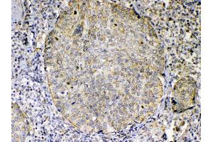 IHC analysis of TNFSF18 using anti-TNFSF18 antibody .