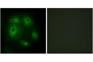 Immunofluorescence analysis of HeLa cells, using DLEC1 Antibody. (DLEC1 anticorps  (AA 1-50))