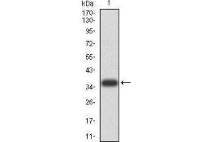 Western blot analysis using FOXM1 mAb against human FOXM1 (AA: 649-748) recombinant protein.