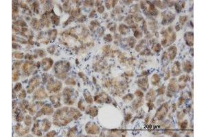 Image no. 1 for anti-Glycine N-Acyltransferase (GLYAT) (AA 64-164) antibody (ABIN599511) (GLYAT anticorps  (AA 64-164))