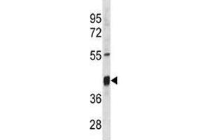 Txnip antibody western blot analysis in mouse stomach tissue lysate. (TXNIP anticorps  (AA 116-145))