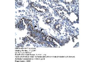 Human Lung (TAF7 anticorps  (N-Term))