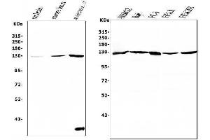 Western blot analysis of RENT1/hUPF1 using anti-RENT1/hUPF1 antibody (ABIN7602979).