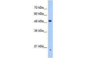 ZDHHC16 antibody used at 1 ug/ml to detect target protein. (ZDHHC16 anticorps  (N-Term))