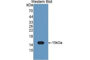 Detection of Recombinant ACYP2, Mouse using Polyclonal Antibody to Acylphosphatase 2 (ACYP2)