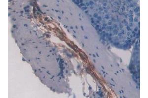 Detection of FBN1 in Rat Testis Tissue using Polyclonal Antibody to Fibrillin 1 (FBN1)