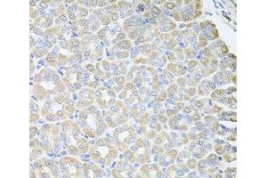 Immunohistochemistry of paraffin-embedded Mouse stomach using SKAP2 Polyclonal Antibody at dilution of 1:100 (40x lens). (SKAP2 anticorps)
