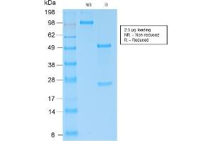 SDS-PAGE Analysis of Purified Kappa Light Chain Rabbit Recombinant Monoclonal (KLC2289R). (Recombinant IGKC anticorps)