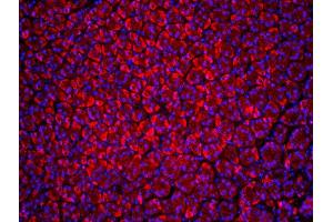 Formalin-fixed and paraffin-embedded rat stomach labeled with Anti-Beclin 1/ATG6 Polyclonal Antibody, Unconjugatedused at 1:200 dilution for 40 minutes at 37°C.