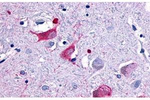 Image no. 1 for anti-Melanin-Concentrating Hormone Receptor 2 (MCHR2) (Cytoplasmic Domain) antibody (ABIN1049055)