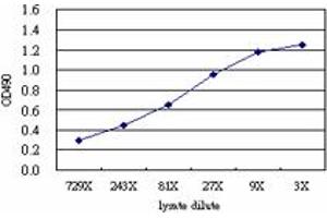 IL6 (Human) Matched Antibody Pair