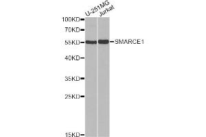 Western blot analysis of extracts of various cell lines, using SMARCE1 antibody. (SMARCE1 anticorps)