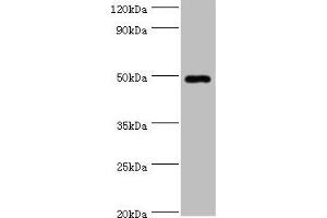 Western blot All lanes: HYAL1 antibody at 2 μg/mL + HepG2 whole cell lysate Secondary Goat polyclonal to rabbit IgG at 1/10000 dilution Predicted band size: 49, 46, 28, 24, 20, 11, 38 kDa Observed band size: 49 kDa (HYAL1 anticorps  (AA 136-435))