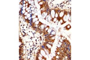 Immunohistochemical analysis of paraffin-embedded H.