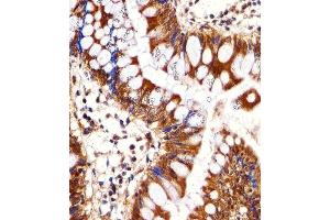 Immunohistochemical analysis of paraffin-embedded H. (PSMC1 anticorps  (C-Term))