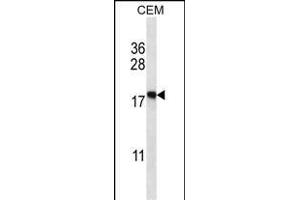 EIF5A2 Antibody (C-term) (ABIN657973 and ABIN2846919) western blot analysis in CEM cell line lysates (35 μg/lane). (EIF5A2 anticorps  (C-Term))