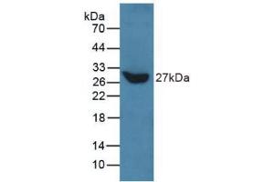 Western blot analysis of recombinant Human TLN.