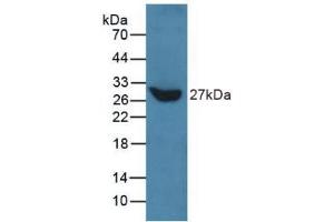 Western blot analysis of recombinant Human TLN. (Talin anticorps  (AA 975-1181))