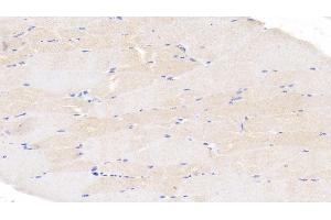 Detection of CASP6 in Bovine Skeletal muscle Tissue using Polyclonal Antibody to Caspase 6 (CASP6) (Caspase 6 anticorps  (AA 194-293))