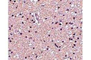 Immunohistochemistry (IHC) image for anti-Stathmin 1 (STMN1) (N-Term) antibody (ABIN1031495) (Stathmin 1 anticorps  (N-Term))