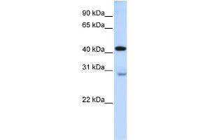 WB Suggested Anti-GRAMD2 Antibody Titration:  0. (GRAMD2 anticorps  (Middle Region))