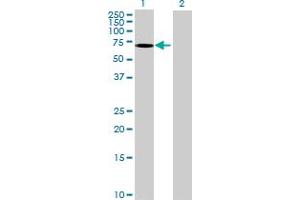 Western Blot analysis of GRB10 expression in transfected 293T cell line ( H00002887-T02 ) by GRB10 MaxPab polyclonal antibody. (GRB10 anticorps  (AA 1-536))