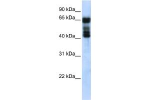 WB Suggested Anti-UGT2B4 Antibody Titration:  0.