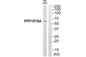 Western blot analysis of extracts from Rat heart cells, using PPP1R16A antibody. (PPP1R16A anticorps)