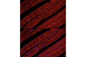 Immunofluorescence analysis of Mouse skeletal muscle using GLUT4 antibody (ABIN6134112, ABIN6147963, ABIN6147964 and ABIN6223551) at dilution of 1:100 (40x lens).