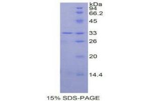 SDS-PAGE (SDS) image for Mitogen-Activated Protein Kinase 14 (MAPK14) (AA 19-279) protein (His tag) (ABIN1877644)