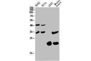 Western Blot analysis of various cells using Antibody diluted at 1:1000. (CCL27 anticorps  (Internal Region))