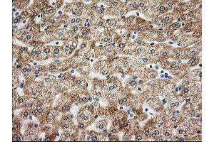 Image no. 5 for anti-Adenylate Kinase 4 (AK4) antibody (ABIN1496524)